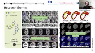 Towards Deep Federated Learning in Healthcare Invited Talk at CVPR21 MCV [upl. by Cirted]