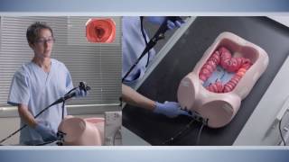 Basics of colonoscopy [upl. by Namrej436]