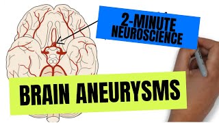 2Minute Neuroscience Brain Aneurysms [upl. by Lonergan]