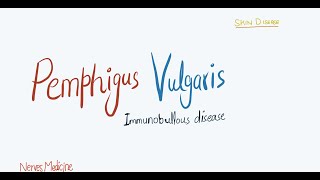 Pemphigus Vulgaris  clinical features pathophysiology and histology  immunobullous skin disease [upl. by Aerdua]