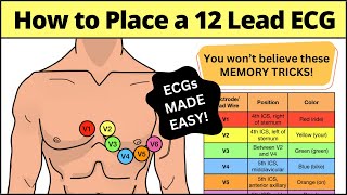 12 Lead ECG Placement MADE EASY EMT Nursing Paramedic ecg nursing [upl. by Nelie240]