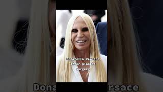 Shocking Transformation Donatella Versaces Plastic Surgery Nightmare shortsviral versace [upl. by Seabrooke]