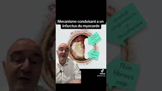 Mécanisme conduisant a un infarctus du myocarde [upl. by Ashien]