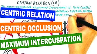 Centric Relation Centric Occlusion amp Maximum Intercuspation [upl. by Suirtimid]