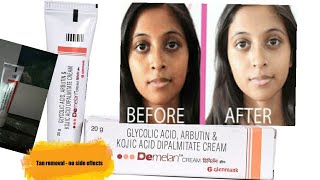 demelan cream uses in tamil  tan removal cream by dermatalogist  review tanremoving [upl. by Earvin]