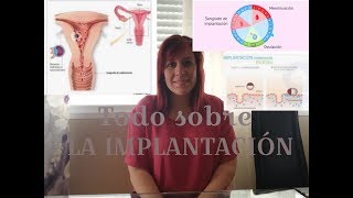 Lo que debes saber sobre la IMPLANTACIÓN [upl. by Hedda973]