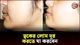 অবাঞ্ছিত লোম দূর করার সহজ উপায়  Channel 24  Unwanted Hair [upl. by Doykos701]