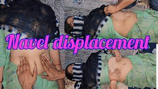 Navel displacement oil massage therapy and L4 L5 slipped disc pain treatment for Ladies [upl. by Jamnes]