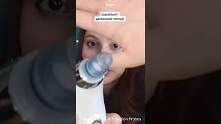 How to use Derma Suction Blackhead Remover Machine  Cell Operated machine [upl. by Nohsram]