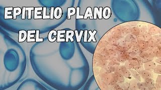 Epitelio plano del cérvix Células planas y sus caracteristicas [upl. by Aidnyl]