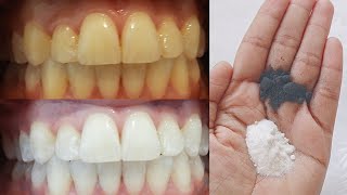 Teeth whitening at home in 2 minutes  Permanent teeth whitening  Home remedies for teeth whitening [upl. by Manny102]