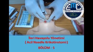 İleri Havayolu Yönetimi  5  Acil Needle Krikotirotomi [upl. by Eslud293]