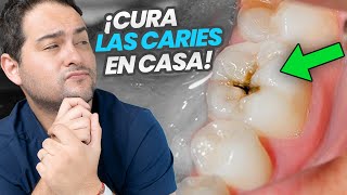 LA VERDAD SOBRE LA CARIES DENTAL ¿Como curarla en casa [upl. by Astrix486]