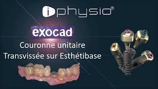 TUTORIEL EXOCAD Esthétibase  iPhysio® [upl. by Evol348]