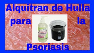 ⚱⚱ Alquitrán de Hulla para la Psoriasis ⚱⚱ [upl. by Gretal]