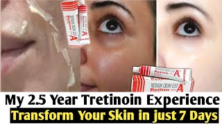 Tretinoin Creamafter using 1 Year full details002500501Pm Skincare with retinAin 2022 [upl. by Dann]