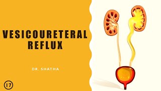 Vesicoureteral Reflux  Drshatha  Lecture 17 [upl. by Evannia58]