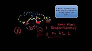 Cranial Nerve VIII 2 of 3 Webers Test [upl. by Ettolrahc]