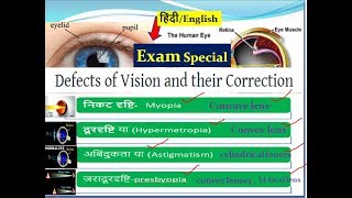 Eyes defect and its correctionsMyopia Hypermetropia Astigmatism [upl. by Shaya351]