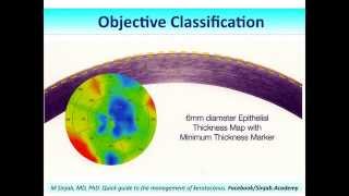 Quick Guide to the Management of Keratoconus Part 4 [upl. by Kitti]