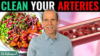 Can a Nutritarian Diet Remove Calcified Plaque in Arteries  Dr Joel Fuhrman [upl. by Reiner588]