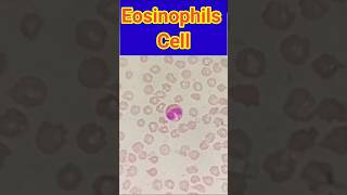 Eosinophils cells  Blood smear  Blood smear microscopy  shorts trendingshorts viral lab [upl. by Atsok958]