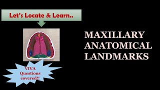 MAXILLARY ANATOMICAL LANDMARKS  MARKING ON MODEL  DENTURE BEARING AREA [upl. by Eelsnia]