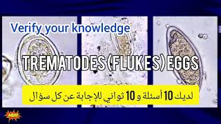 Trematodes identification training quiz أسئلة مختبرات طبية بيرسون فيو برومتريك أخصائي فني هيئة [upl. by Nhguahs479]