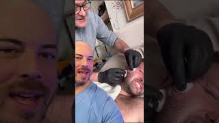 This is an EPIC cyst pop on the cheek 😵‍💫 trending skincare viralvideo [upl. by Atkins]