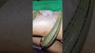 eczema treatment  Leech Therapy for eczema shortsfeed alternativemedicine alternativemedicine [upl. by Yearwood621]