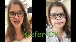 Meine KieferOP  Vlog  297  88 [upl. by Hertha]