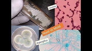 Study of fungi  Yeast and mold [upl. by Vijnas]