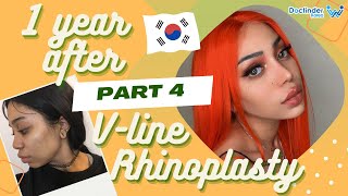 MY PLASTIC SURGERY EXPERIENCE IN KOREA  Rhinoplasty amp V Line Surgery Before and After Part 4 [upl. by Azerila431]