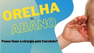 Orelha de Abano ou Otoplastia posso fazer pelo Convênio [upl. by Andriette]