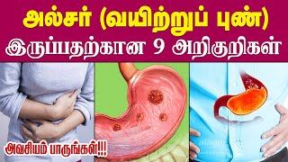 அல்சர் அறிகுறிகள்  Ulcer Symptoms in Tamil Causes of Stomach Ulcers  Signs of Ulcer Health Tips [upl. by Nosreh]