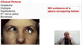 Pseudotumor Cerebri Benign increase of Intracranial Pressure [upl. by Kamal]