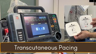 Crash Cart 04 Transcutaneous Pacing TCP [upl. by Alahc]