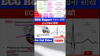 ECG Report देखना सीखें biology science nursing medical pharmac pharmacian education [upl. by Lemkul]