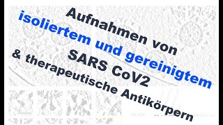 Aufnahmen von isoliertem und gereinigtem SARS CoV2 und Entwicklung therapeutischer Antikörper [upl. by Monney]