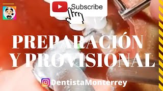 ⏩PREPARACIÓN DENTAL y PROVISIONAL👅QuickVideo PreparacionesDentales [upl. by Kylie]