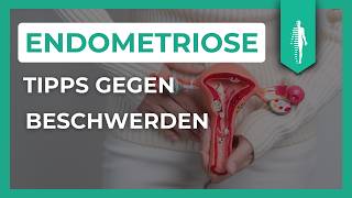 Pille Schmerzmittel amp Alternativen Die besten Tipps für Endometriose und Adenomyose [upl. by Seligmann]