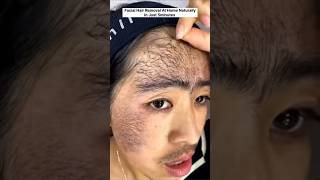 🔥Remove Facial Hair Naturally At Home In 5MinUpper Lips amp Unwanted Facial Hair Removalshortsviral [upl. by Beatty]