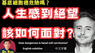 基底細胞癌是什麼樣的一種病？人生感到絕望該如何自處？What to do if you experience hopelessness in life [upl. by Enyamart]