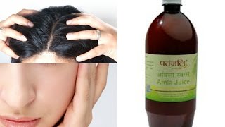 Top 5 ways to use Amla Juice  Benefits of amla juice in skincare haircare amp health [upl. by Akamahs]