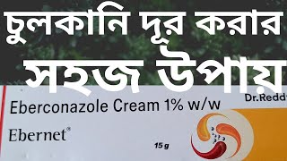 চুলকানি দূর করার সহজ উপায় Ebernet Cream [upl. by Coyle916]