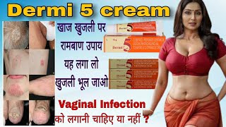 Dermi 5 cream  खाज खुजली होने पर क्या लगाए  fungal infection cream dermi5cream [upl. by Dagney484]