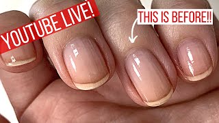 Fixing cuticles for good How to do this the EASY WAY [upl. by Nirej]