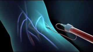 Blood Test for Cholesterol  Nucleus Health [upl. by Partridge]