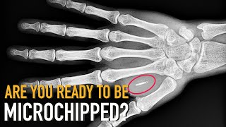 Are you ready to be microchipped [upl. by Chalmers]