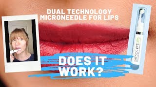 Microneedle Lips Mesolyft Lips Review  Pros and Cons [upl. by Yanrahc]